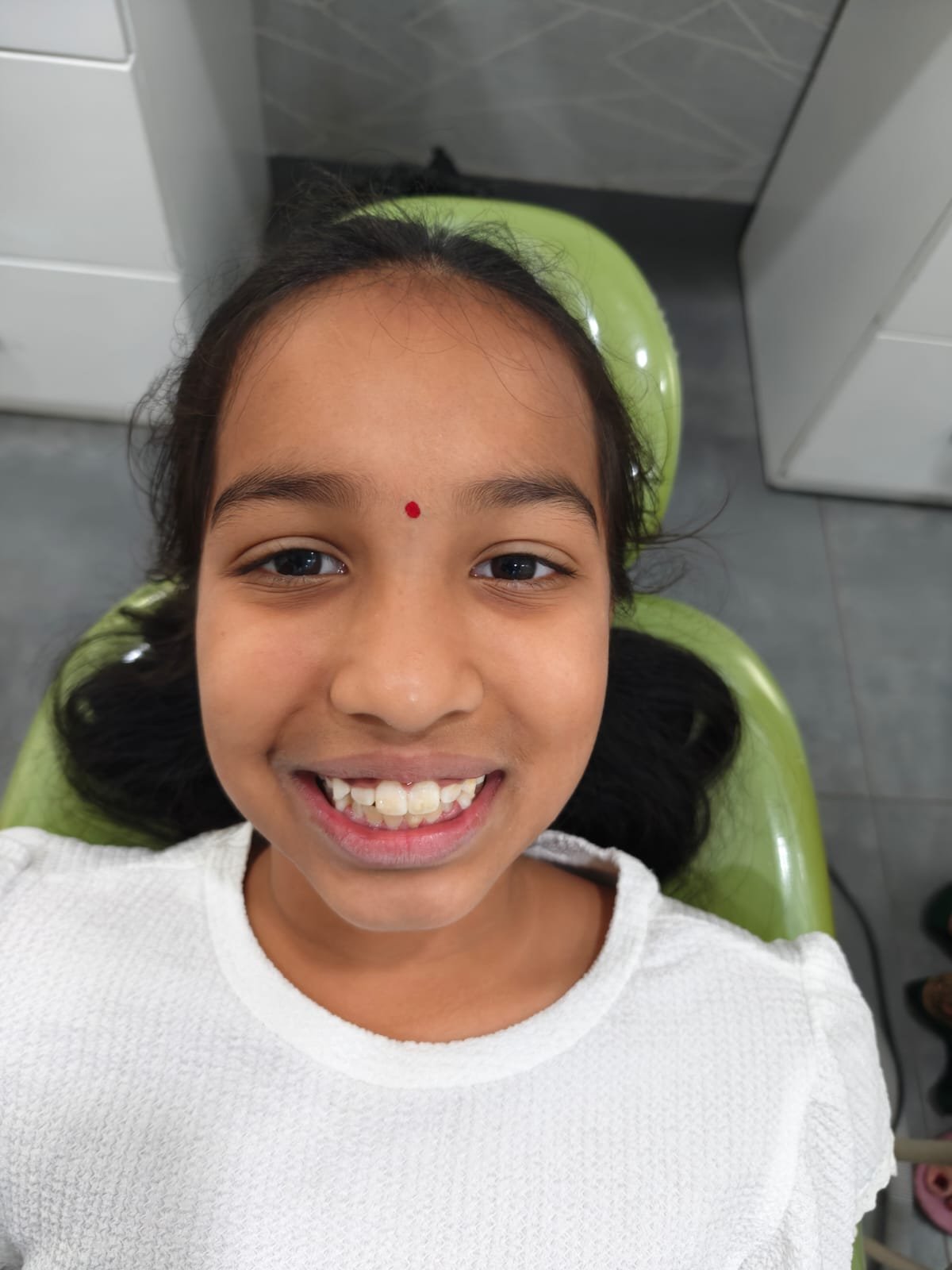 Young Patient — Post Treatment Smile