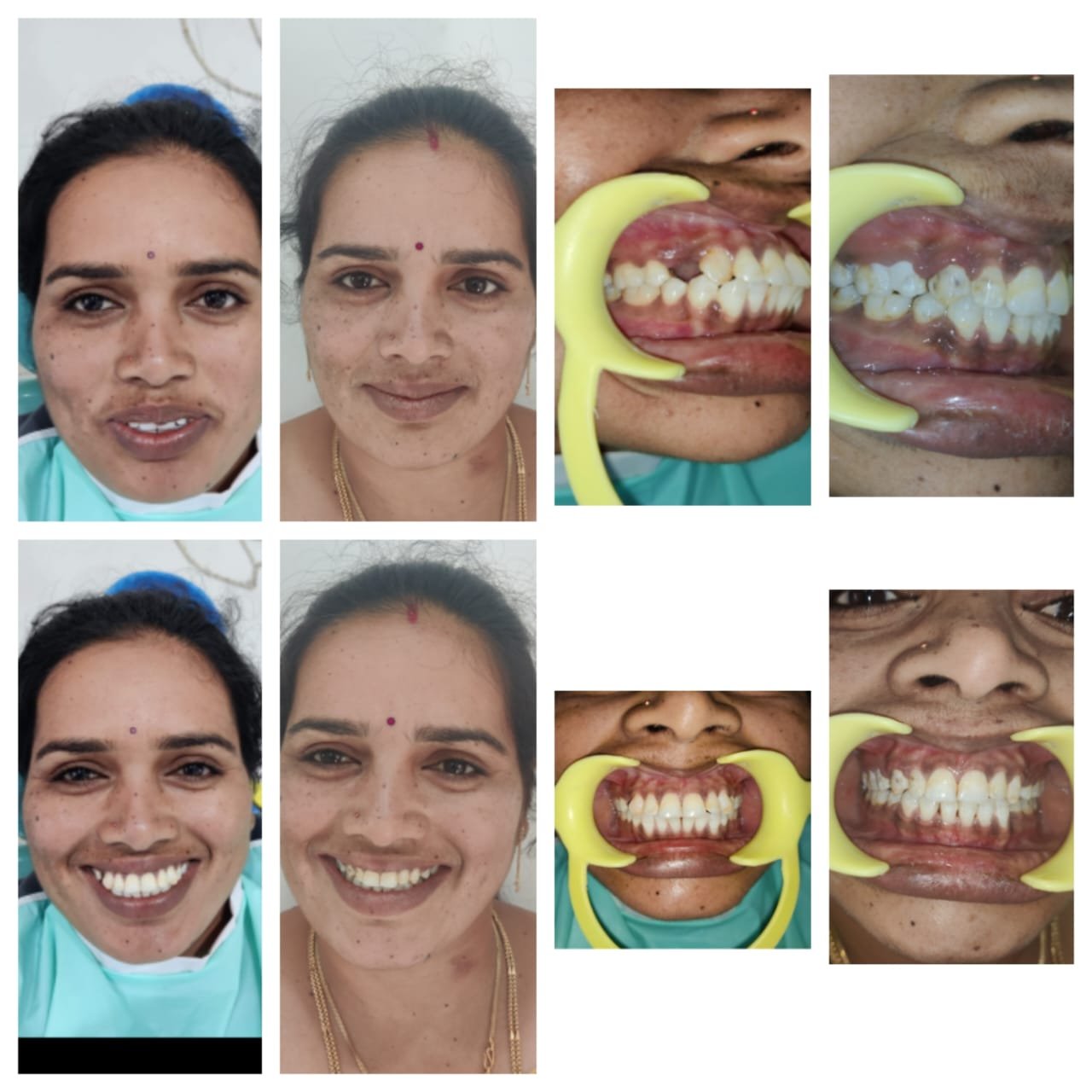 Full Case — Face & Teeth Before & After