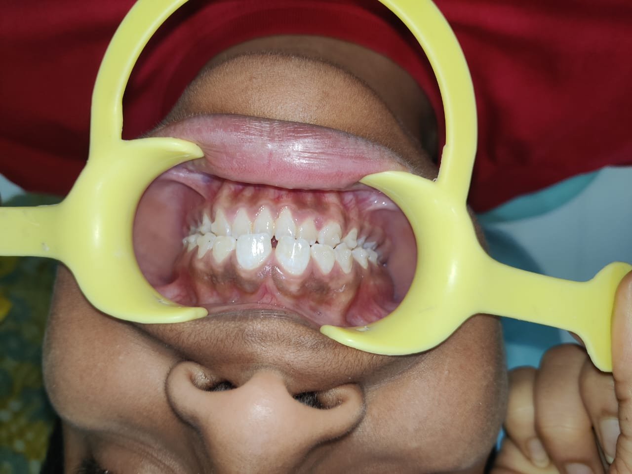 Orthodontic Assessment