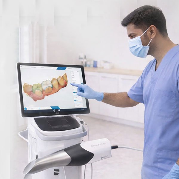 CBCT Machine
